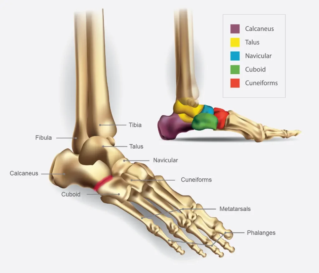 Illustration showing cuboid syndrome as a potential cause of outer foot pain in runners, highlighting the cuboid bone and surrounding structures.