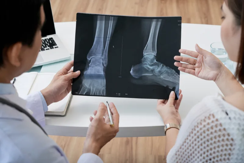 Two doctors examining an X-ray of a patient's foot, focusing on the heel area