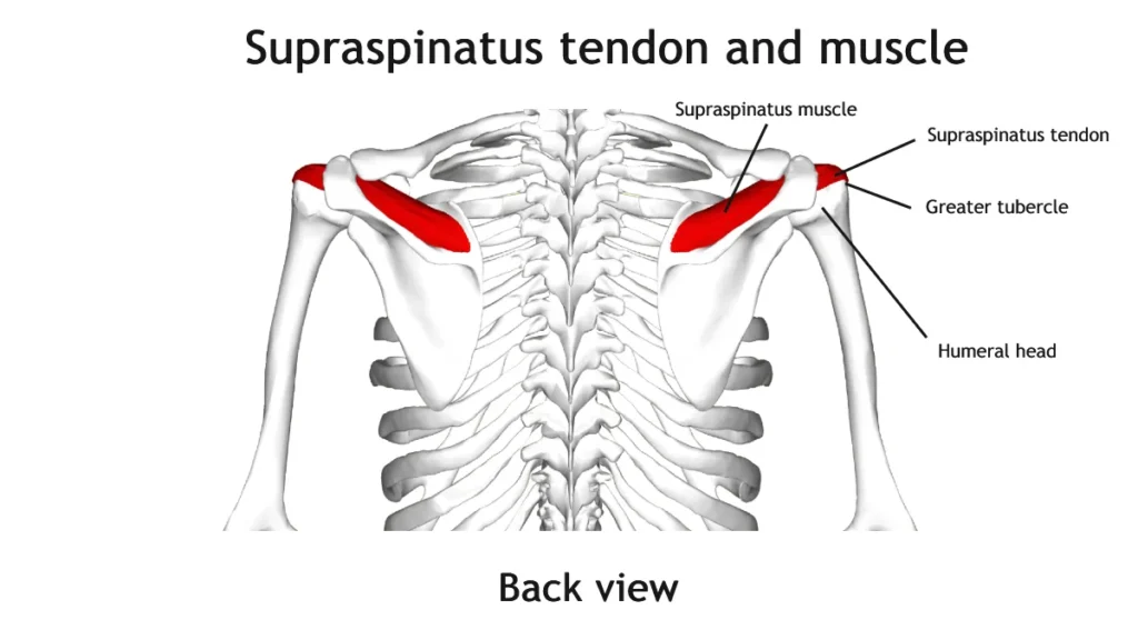Posterior view of the supraspinatus muscle and tendon, showing tendon course under the acromion and rotator cuff anatomy.