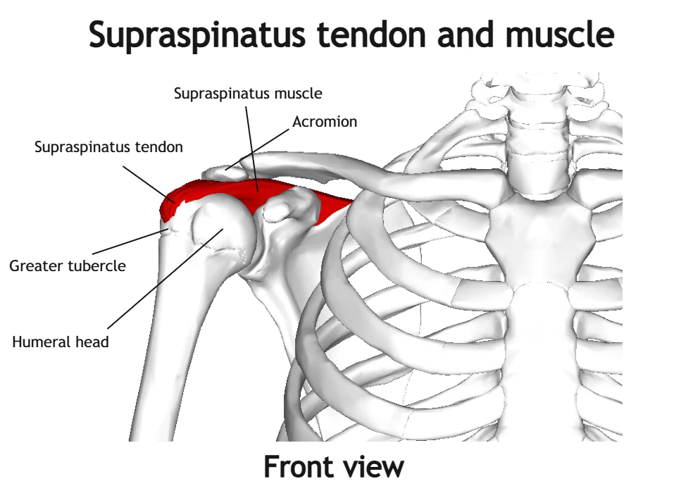Anterior view of the supraspinatus muscle and tendon, showing tendon insertion on the humerus and muscle structure of the rotator cuff.
