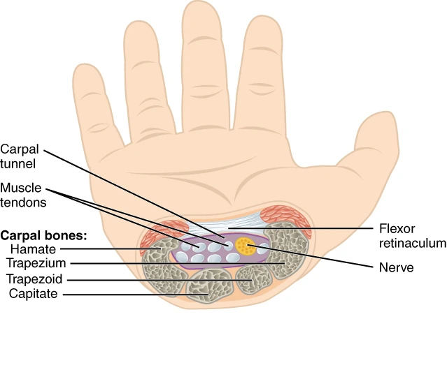 Schematic illustration of carpal tunnel anatomy showing the median nerve, flexor tendons, and transverse carpal ligament.