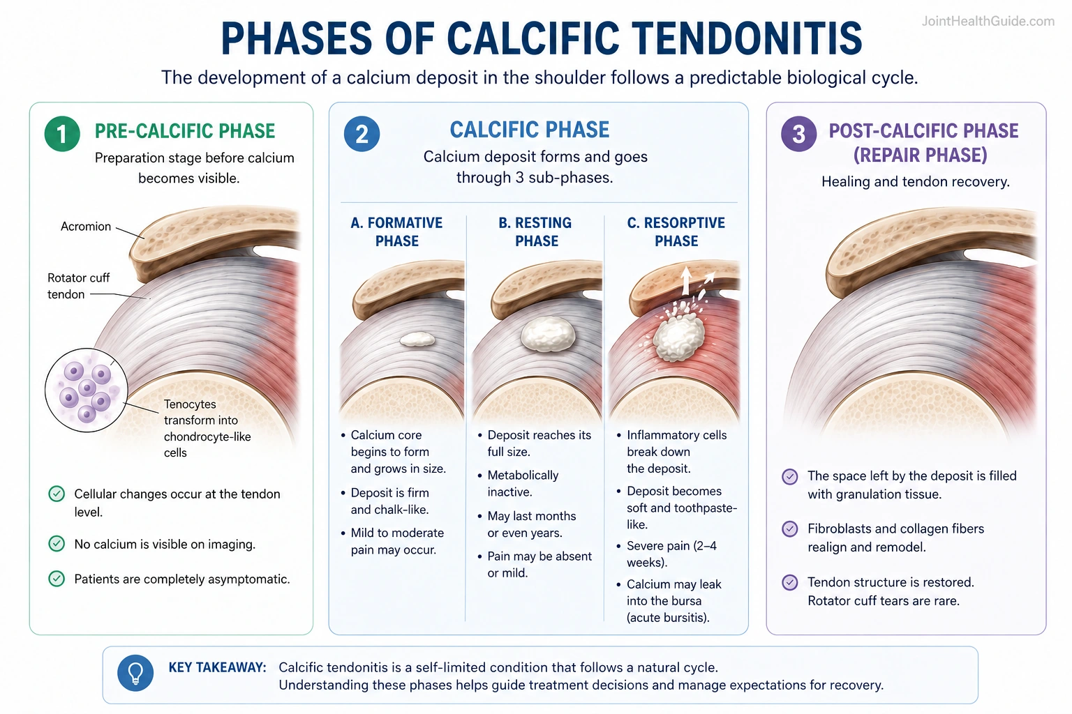 Medical infographic showing the stages of calcific tendinopathy of the shoulder, including the pre-calcific phase, calcific formative phase, resting phase, resorptive phase, and post-calcific healing phase with rotator cuff tendon illustrations.