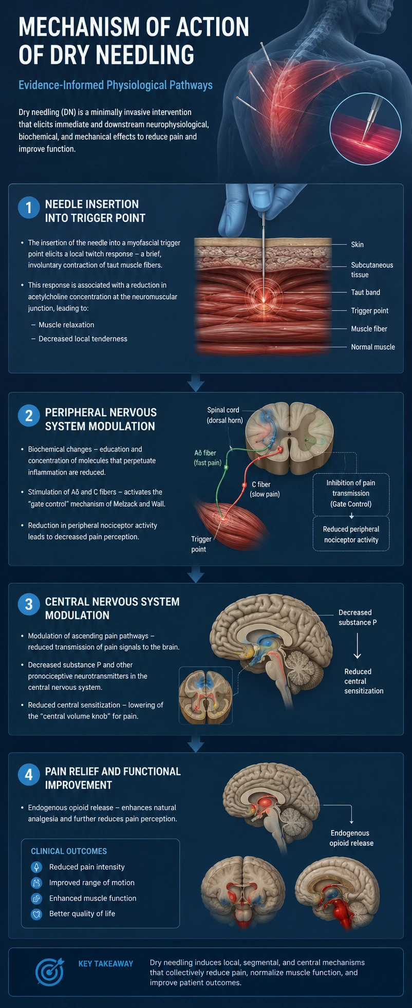 Medical infographic illustrating the mechanism of action of dry needling treatment — needle insertion into trigger points, peripheral nerve modulation, spinal cord pain inhibition, and brainstem opioid release.