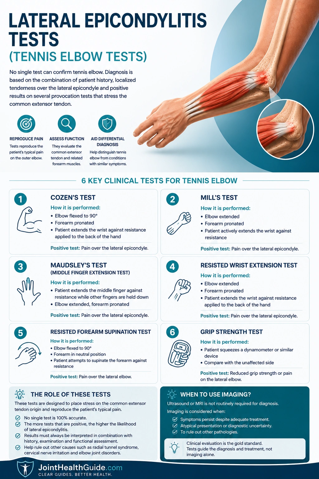 Infographic showing six clinical tests for tennis elbow (lateral epicondylitis), including Cozen’s test, Mill’s test, Maudsley’s test, resisted wrist extension test, resisted forearm supination test, and grip strength test used to assess common extensor tendon pain at the lateral elbow.