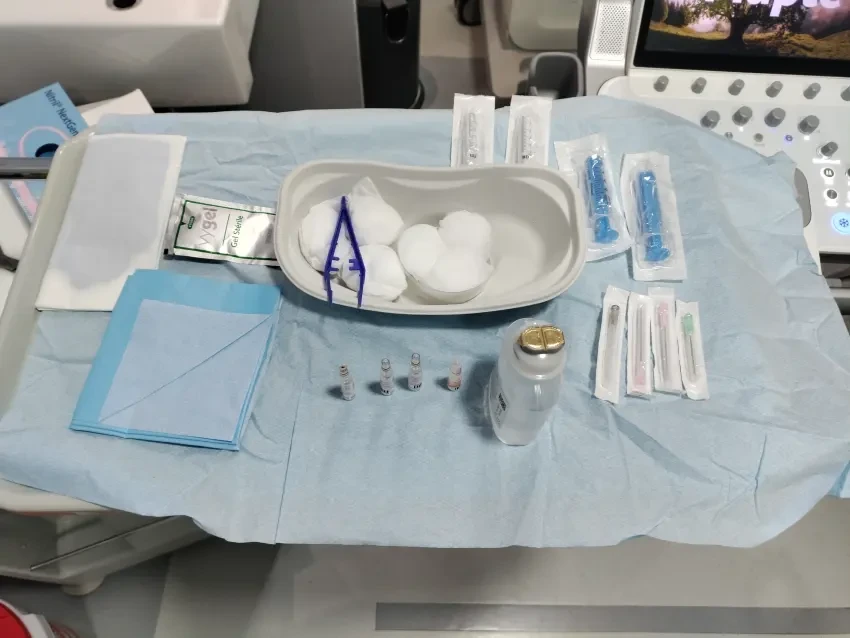 Sterile equipment and materials prepared for an ultrasound-guided barbotage procedure for calcific tendonitis.